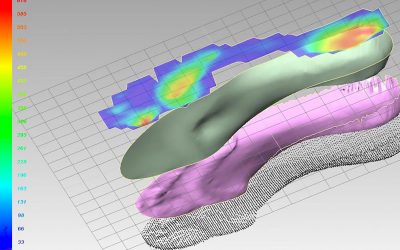 plantari-cad-cam